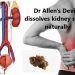 Dr Allen’s Device Cleans Kidneys from Stones Naturally