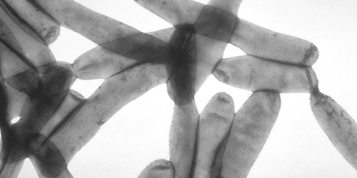 The Toxin Behind Legionella Growth Identified
