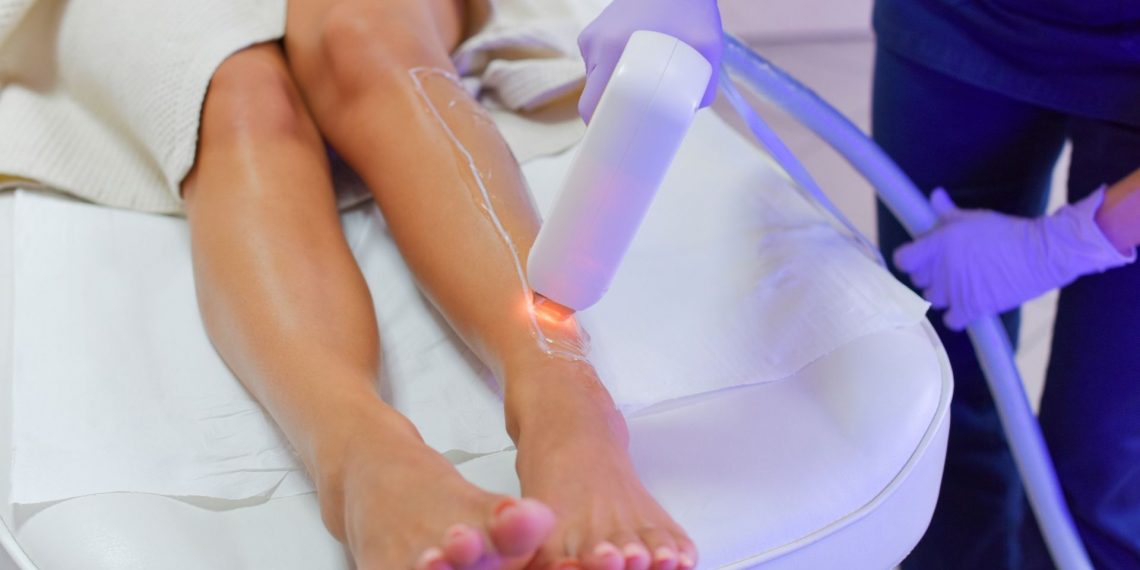 Home vs. Professional Laser Hair Removal: What’s the Difference?